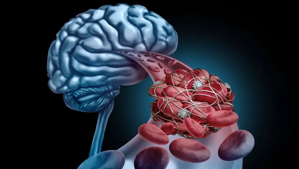 Desvendando o Mini Exame do Estado Mental na Medicina