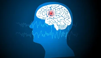 Epilepsia e convulsões