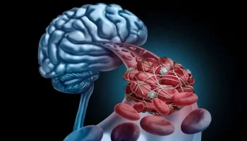 Desvendando o Mini Exame do Estado Mental na Medicina